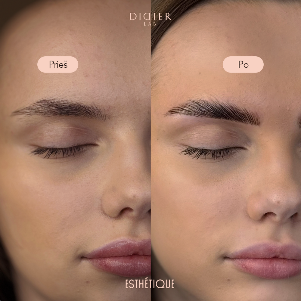 before-after-esth-