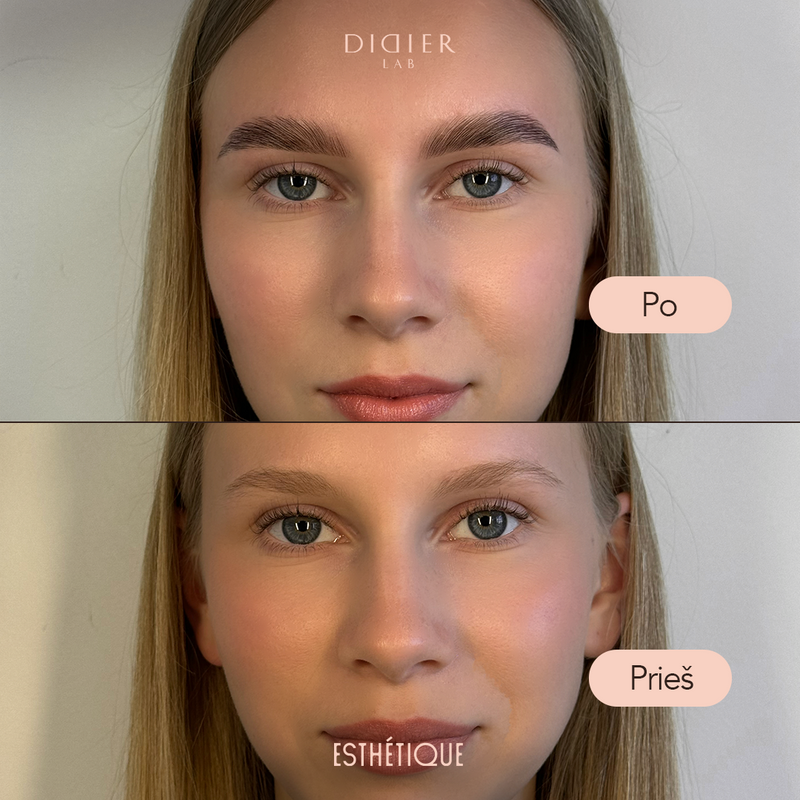 Antakių procedūrų ir priežiūros rinkinys + DOVANA, Didier Lab Esthétique
